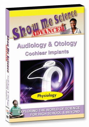 Audiology & Otology ‚Äì Cochlear Implants